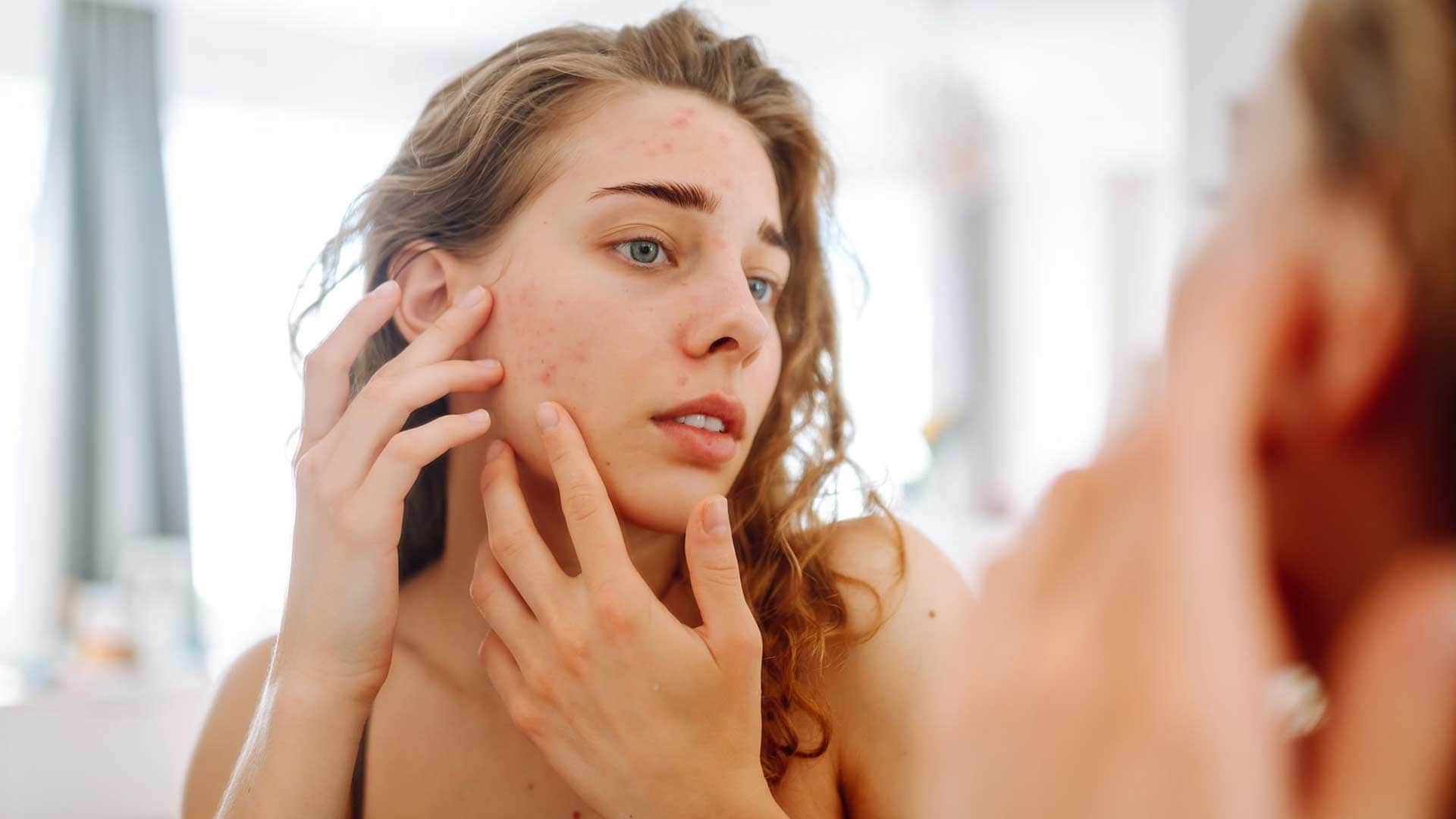 Background image for Skin Picking (Dermatillomania) Hypnotherapy