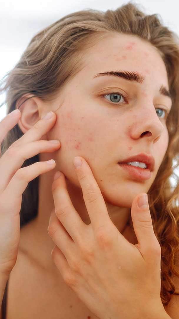 Background image for Skin Picking (Dermatillomania) Hypnotherapy